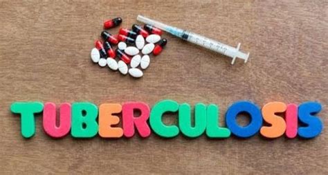 Aturan Minum Obat Herbal TBC Tulang