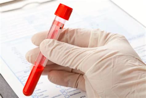 Available At-Home Blood Testing Options