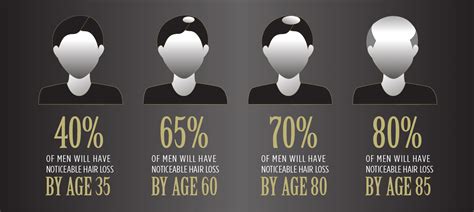 Average Age Of Male Pattern Baldness