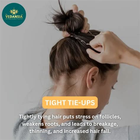 Avoid Sharing Hair Accessories