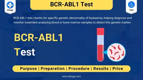 BCR-ABL1 Quantitative Test and interpretation
