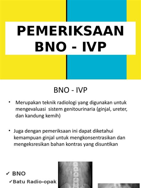 BNO IVP: Essentials & What Matters Most.