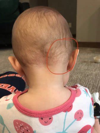 Baby Bump Back Of Head