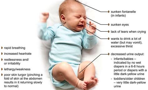 Baby Dehydration: Signs & Quick Relief Tips
