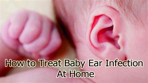 Baby Ear Infection: Signs & What to Do
