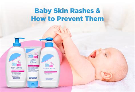 Baby Skin Problems: Prevention & Solutions