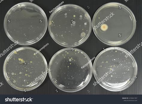 Bacteria Colony Growth