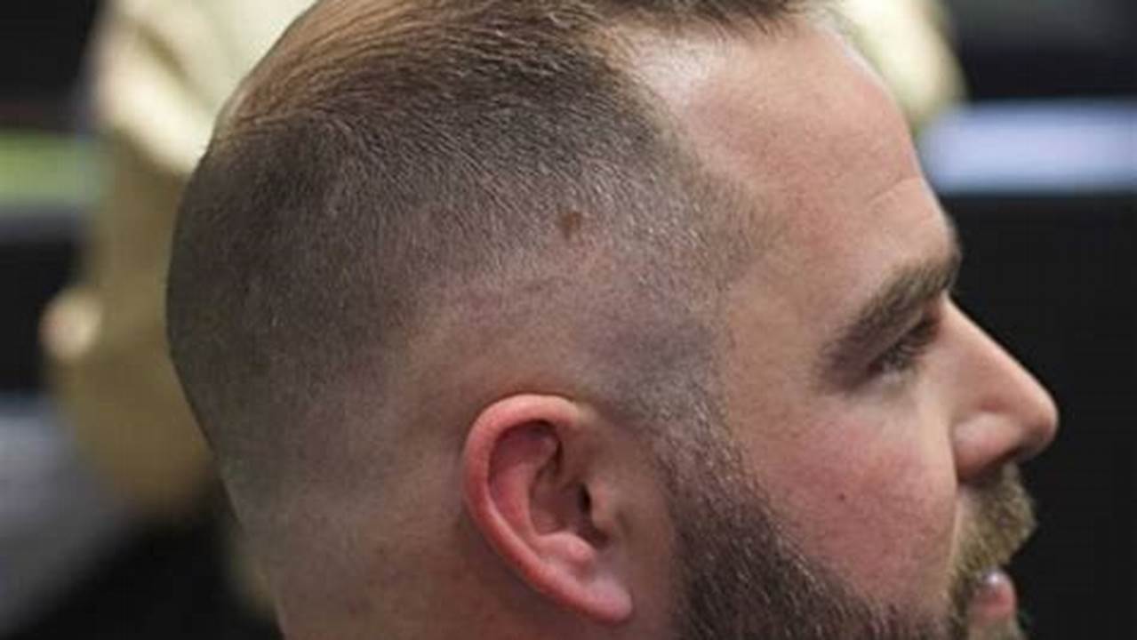 Balding Mens Haircuts 2024