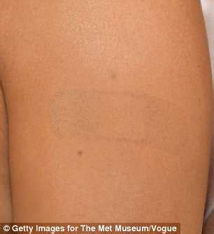 Get Rid of the Unsightly Band-Aid Mark on Your Skin with These Simple Tips