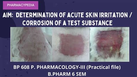 Protect Your Skin from Battery Corrosion: Expert Tips and Prevention Strategies