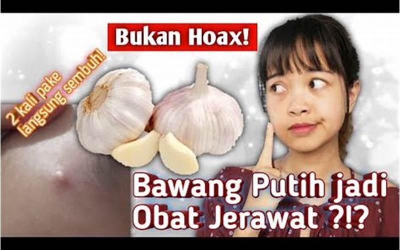 Bawang Putih Untuk Jerawat, Apakah Bahayanya?