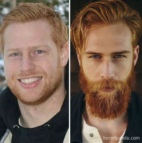 Beard Before And After