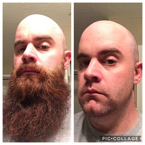 Beard Clean Up Before And After