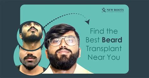 Beard Doctor Near Me