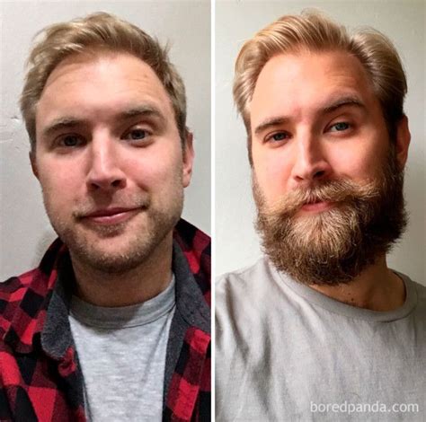 Beard Growth Before And After