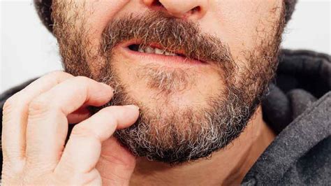 Beard Growth Oil Side Effects