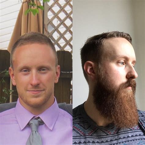 Beard Progress Pictures Reddit