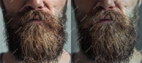 Beard Transformation