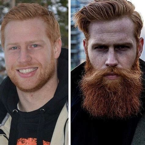 Beard Transformation Before And After