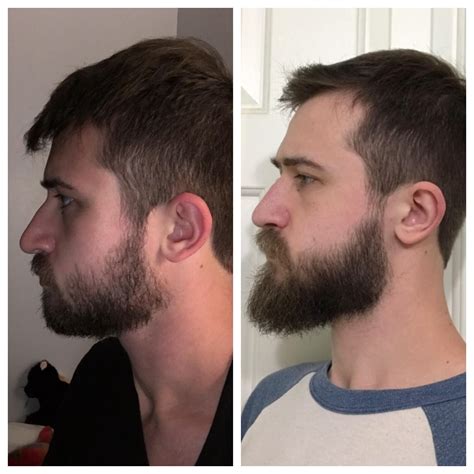 Beard Trimming Styles Under Chin