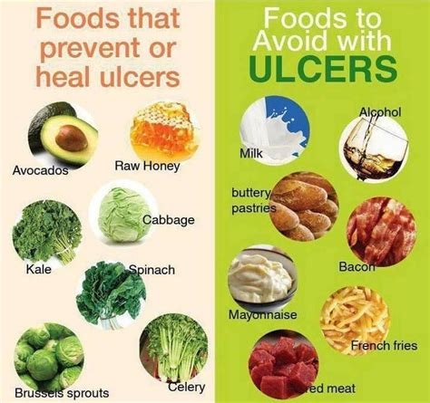 Beat Recurring Ulcers: Fasting-Friendly Tips