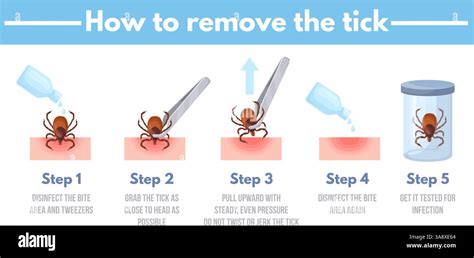 Beautiful How To Safely Remove A Tick
