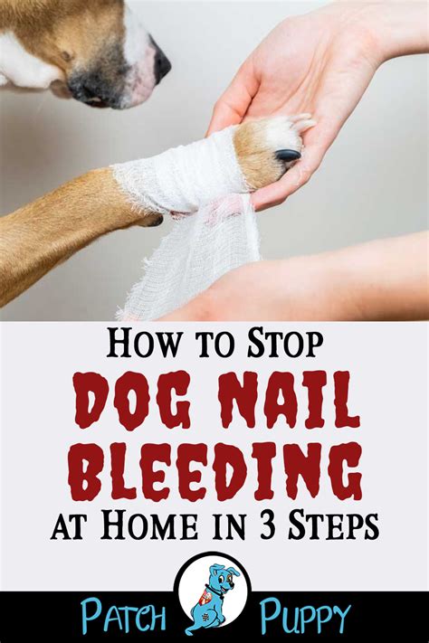 Beautiful How To Stop A Dogs Nail From Bleeding
