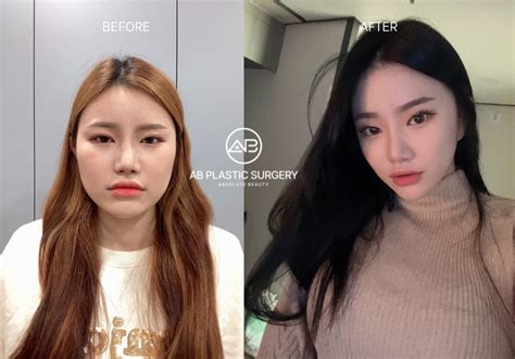 Beauty Standards/Plastic Surgery