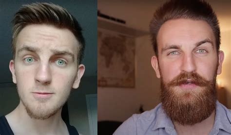 Before And After Beard Growth