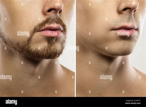 Before And After Shaving Hair