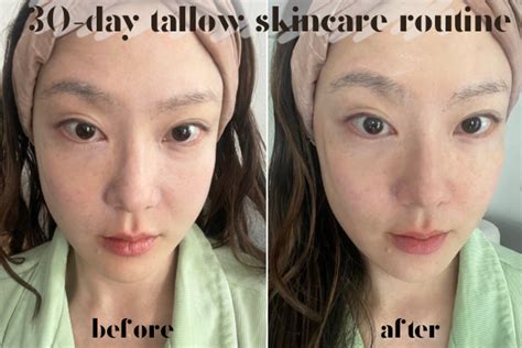 Transform Your Skin with the Incredible Before and After Effects of Tallow