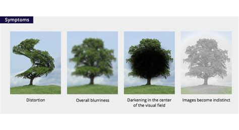 Behavioral Changes Associated with Vision Loss