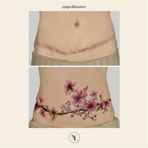 Belly Button Tattoos To Cover Scar