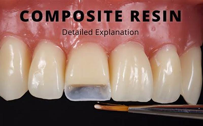 Benefits Of Resin Composite 1S Posterior