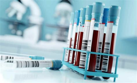Benefits of At-Home Blood Testing