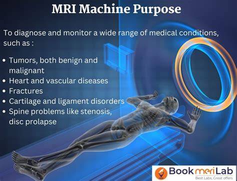 Benefits of MRI