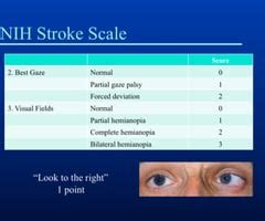 Benefits of Using Quizlet for NIHSS
