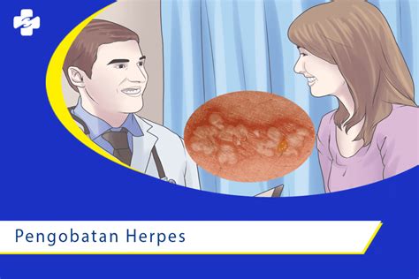 Berapa Lama Pengobatan Herpes Dengan Obat Herbal?