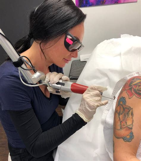 How does laser tattoo removal work? Contour Cafe
