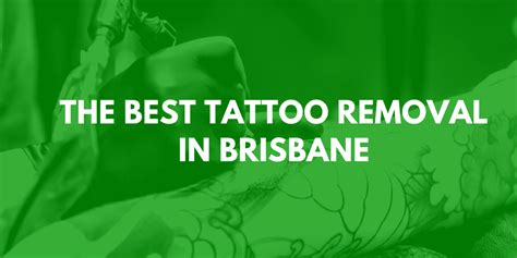 Tattoo Removal Service How To Approach Tattoo removal