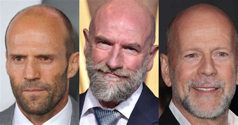 Best Beards For Bald Guys