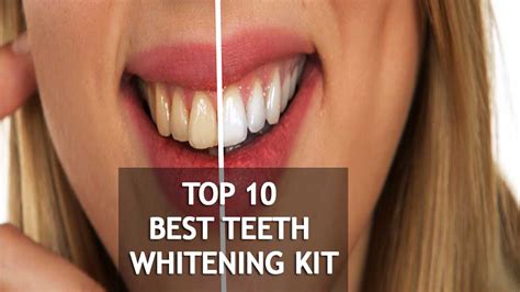 Best Teeth Whitening For Sensitive Teeth