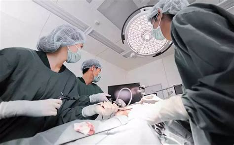 Biaya Operasi Usus Buntu