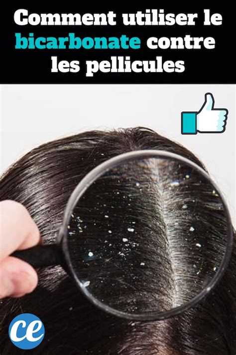 Bicarbonate de soude pellicules