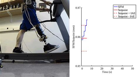 Biomedical Engineering Amputation