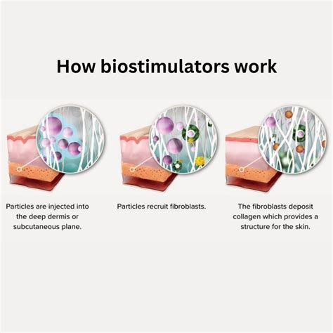 Biostimulators and Skin Boosters