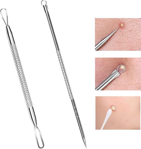 Blackhead Removal: Tools & Safe Techniques