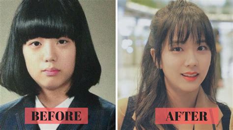 Blackpink Plastic Surgery