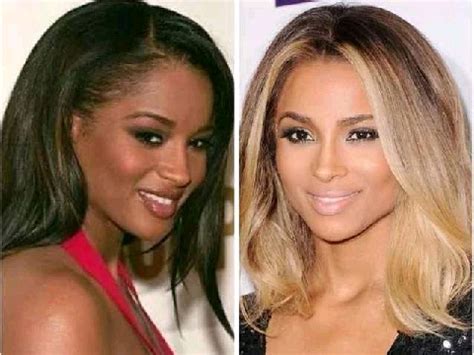 Dramatic Transformation: From Uneven Skin to a Radiant Glow with Bleached Skin Before and After Results