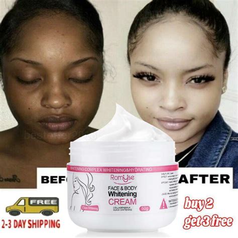 Unlock Radiant, Fairer Skin with the Best Bleaching Cream for Black Skin!